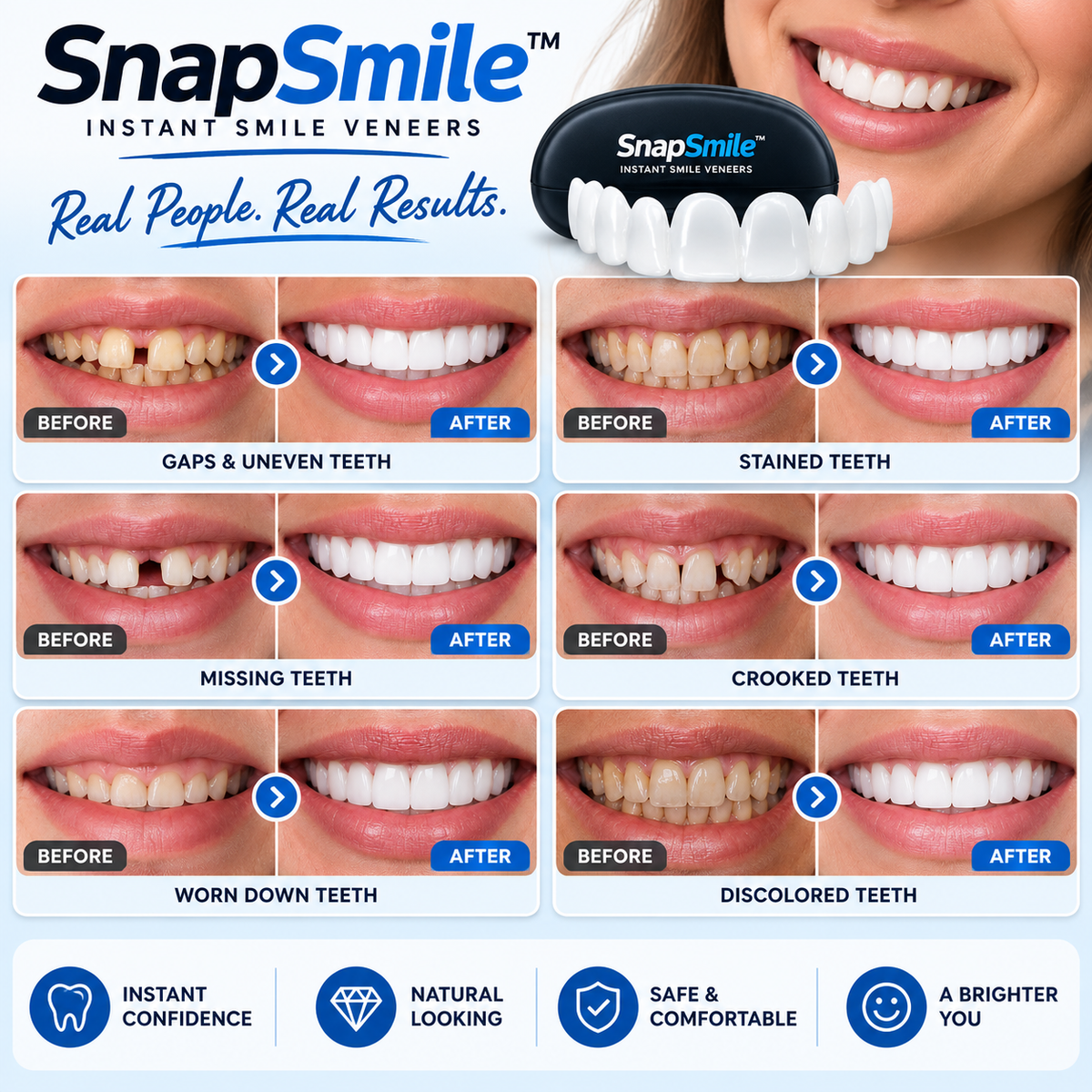 SnapSmile™ Premium Cosmetic Teeth