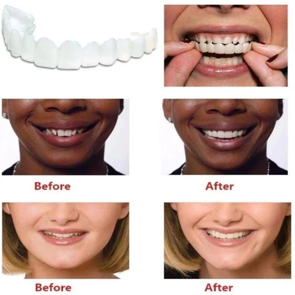 Smile Snap On Upper + Lower False Teeth Dental Veneers Denture Tooth Cover Set