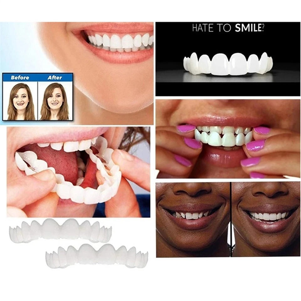 Smile Snap On Upper + Lower False Teeth Dental Veneers Denture Tooth Cover Set