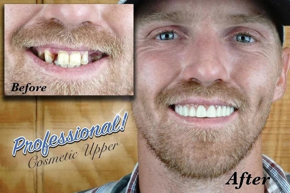 Luxury Cosmetic Upper: Handcrafted Realistic Teeth for At-Home Smile Makeover