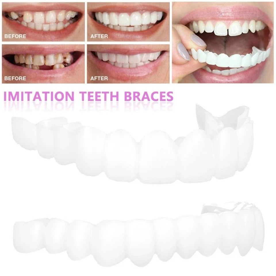 Smile Snap On Upper + Lower False Teeth Dental Veneers Denture Tooth Cover Set